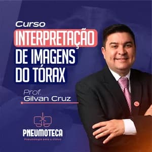 Interpretação de Imagens do Tórax